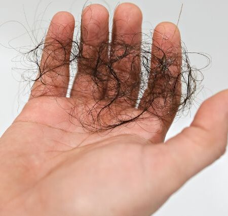 simple-guide-to-treating-hair-loss-after-covid-19